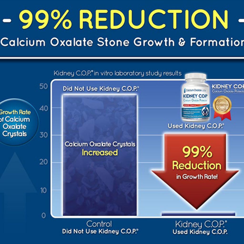 99% Reduction of Calcium Oxalate Stones