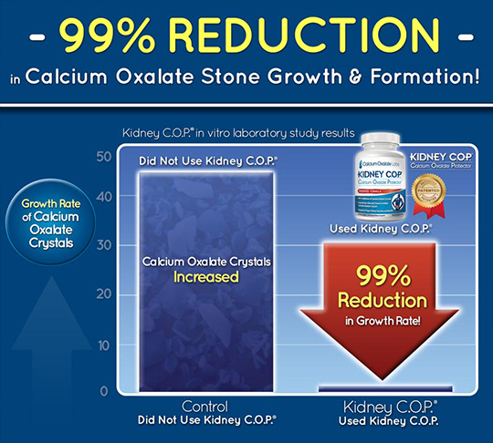 99% Reduction of Calcium Oxalate Stones